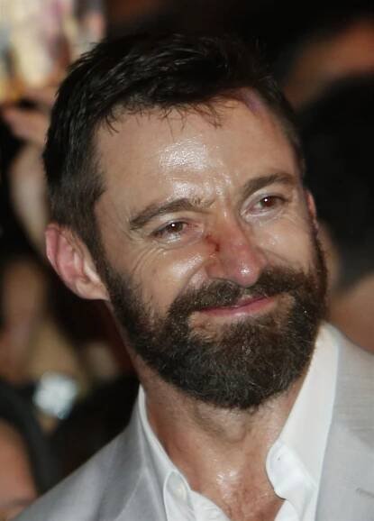 Černochová bojovala s bazaliomem. Totéž řešil i Jackman nebo Ramsay