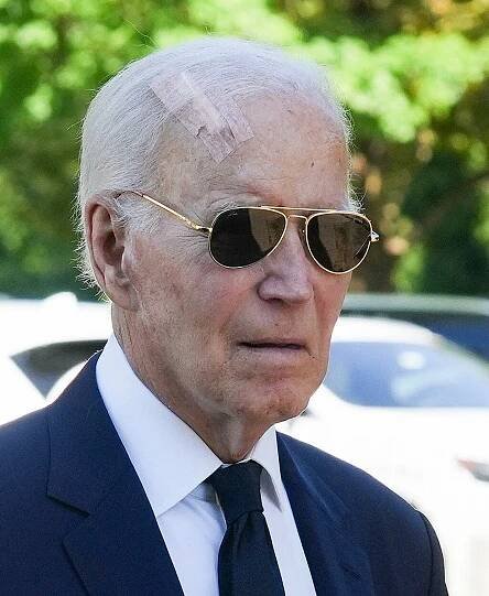 Biden využil Mohsovu chirurgii, kvůli rakovině mu odstranili tkáň z hlavy