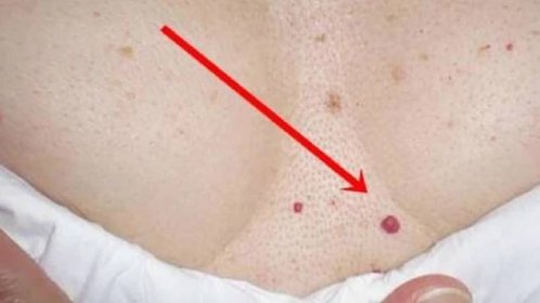 Pokud máte i vy tyto červené fleky na různých částech těla, ihned si pozorně přečtěte tento článek!