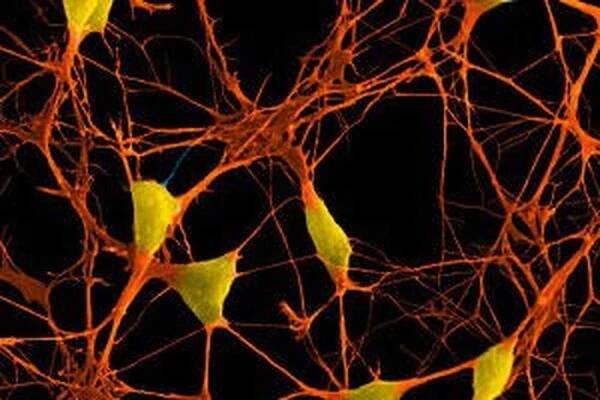Periferní neuropatie / Neuropatie