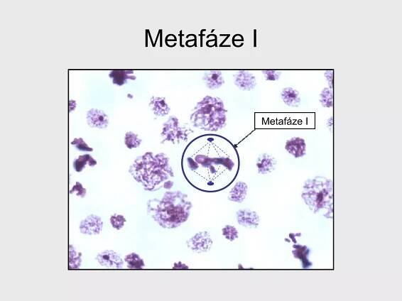 Metafáze I Metafáze I 