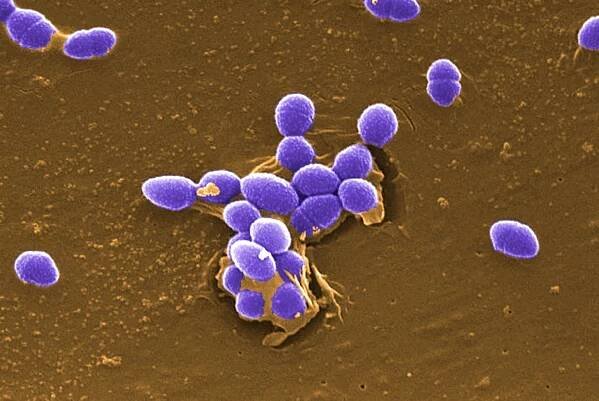 velké, čísla, gram, pozitivní, enterococcus faecalis, bakterie