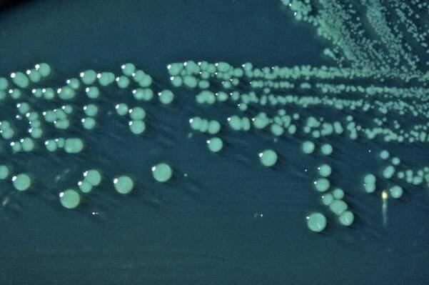 Shigella boydii, bakterie, hektoen, střevní, agar, povrchu, kolonie, boydii, bakterie