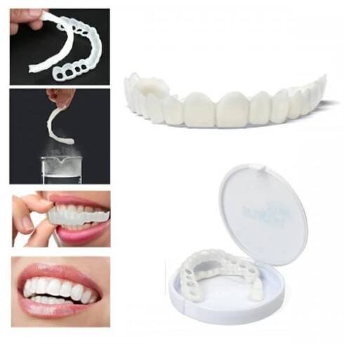 Snap-On-Smile provizorní zubní můstek