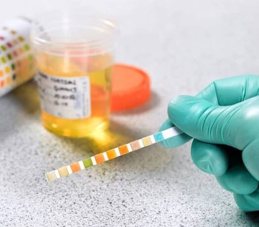 A hand holds a drug test strip; a urine specimen is in the background.