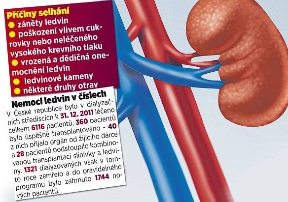 Syn miss Váchové Davídek se narodil s nemocí ledvin! Nepodceňujte preventivní prohlídky!