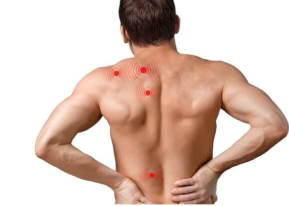Trigger point image. Man with no shirt. Red marks hi-light his pain from trigger points