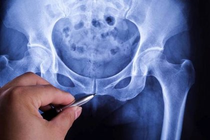 diagnostika rentgenového záření lidské pánve - kostrč - stock snímky, obrázky a fotky