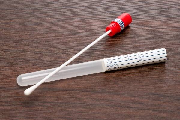 DNA test, wipe testu — Stock obrázek