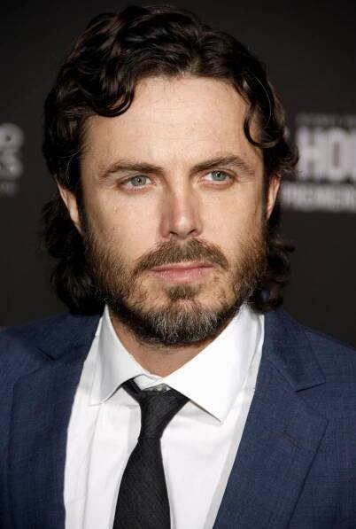 50 Celebrities Who Have Had Hair Transplants