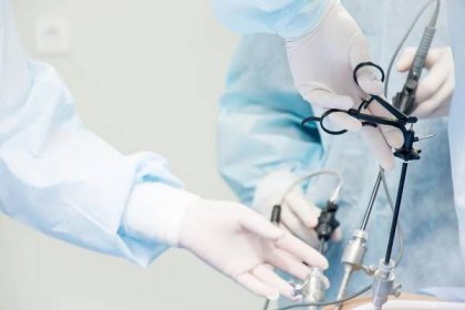chirurg provádí laparoskopickou operaci břicha. detail laparoskopu a rukou lékaře - laparoskopická chirurgie - stock snímky, obrázky a fotky