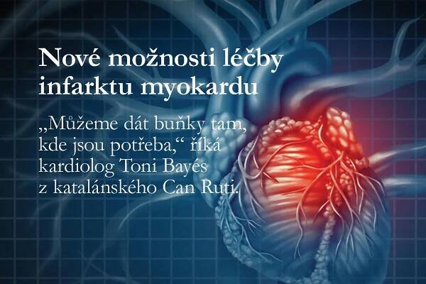 Bioimplantát z tkáně pupečníku dokáže regenerovat srdce po infarktu myokardu - Národní centrum tkání a buněk