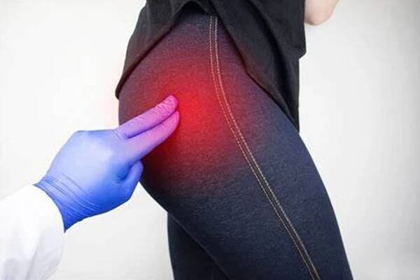 Trochanteric Bursitis and PT