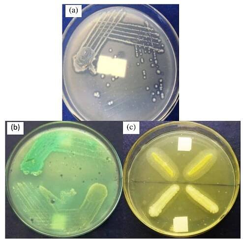 Figure 1: Screening of Lipolytic activity on (a) tributyrin agar medium (b) egg-yolk medium (c) tween 80 medium  Totally, 14 strains showed lipolytic activity on these screening media and their microscopic morphology was shown in (Table 1). 