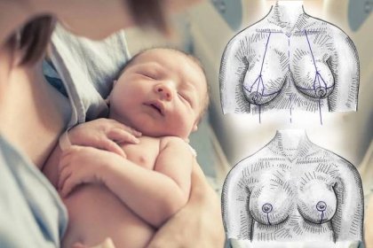Tělo po porodu není ideální. Jak jej dát opět do formy? | Zdraví a krása