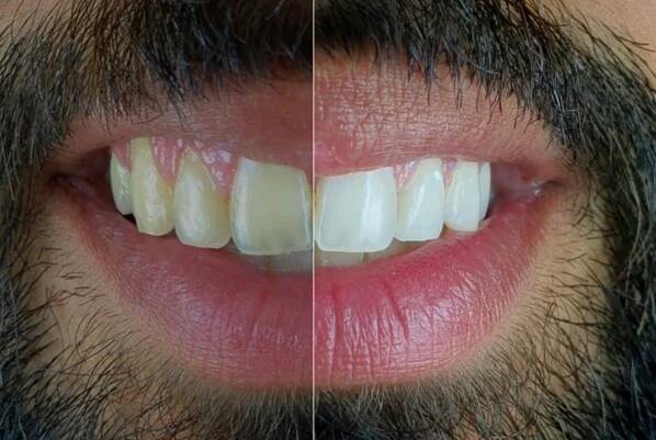 The 12-Month Smile Transformation