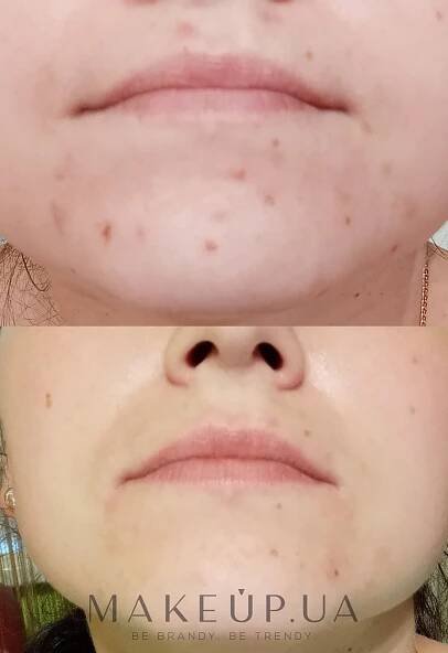 Revitalizační krém pro problematickou pleť - Medi Peel Cica Antio Cream | Makeup.cz