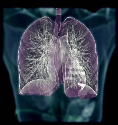 ct hrudník nebo plíce 3d vykreslování obraz na rozmazaném pozadí lidského těla pro diagnostiku tbc,tuberkulózy a covid-19 . - plicní embolie - stock snímky, obrázky a fotky