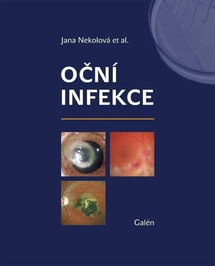 Oční infekce - Jana Nekolová (2021, pevná) od 553 Kč