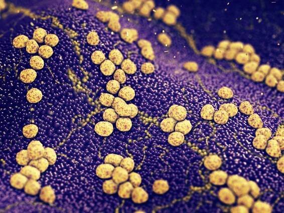 Good bacteria commonly found in probiotics eliminate staph bacteria
