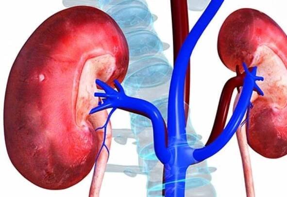 Infarktové příčiny ledvin a symptomy nebezpečné patologie / Články