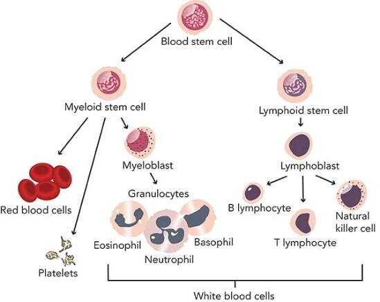 Acute lymphocytic leukemia treatment diagnosis