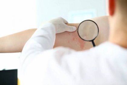 Dermatolog zkoumá červenou vyrážku na kůži pacienta