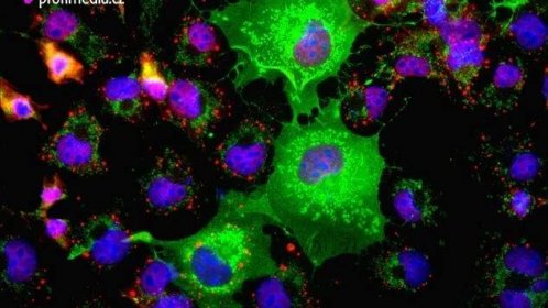 Vědci si poprvé prohlédli celý genom rakoviny plic a kůže - Novinky