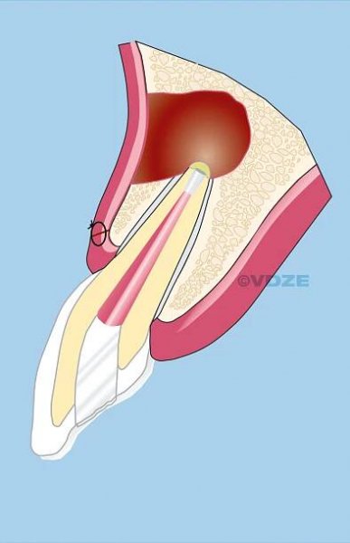CHIRURGIE_4