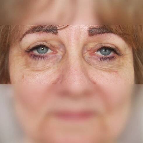 Image after