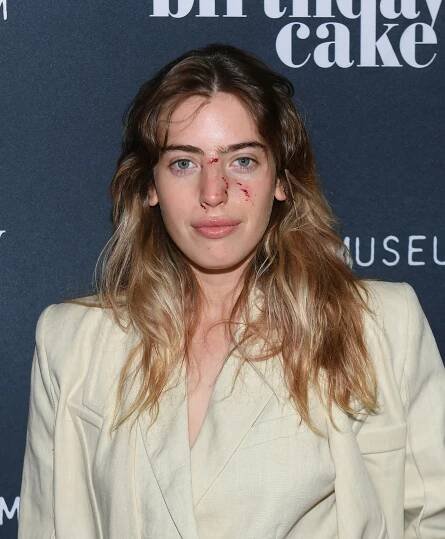 Ewan McGregor's daughter Clara's face bitten by dog