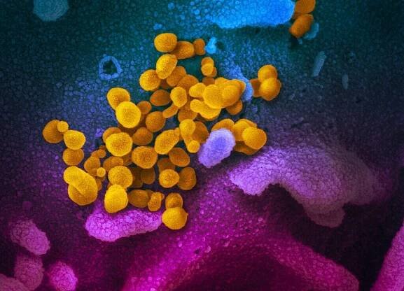 SARS-CoV-2_(yellow)