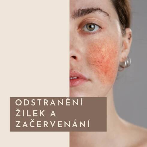 Estetická medicína - MUDr. Lilla Smižanský-Bari – Dermatolog Prostějov