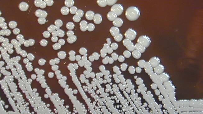 What is melioidosis? Symptoms and treatment...