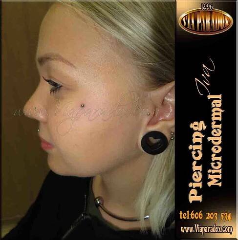 Microdermal - Via Paradox