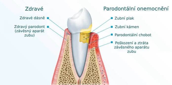 Dentální hygiena