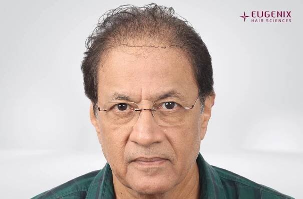 Arun Govil Front Planning