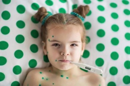 Jak léčit plané neštovice u dětí - Novinky Česká republika