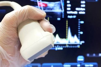 Ultrasound Imaging Needle to Transform Heart Surgery