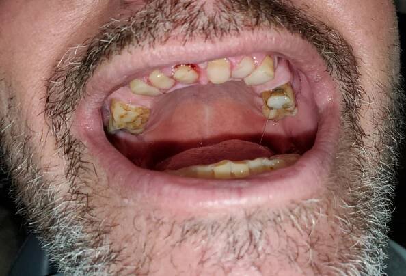 - Eldersburg Dentistry Maryland