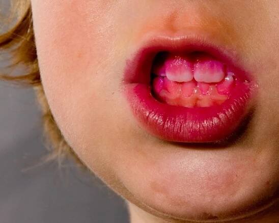 How Dentists can Unintentionally Offend Patients