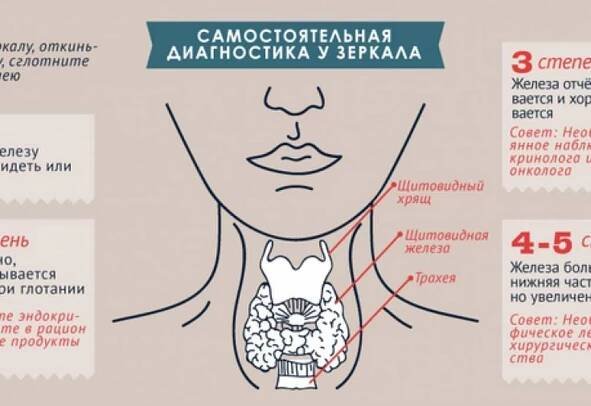 Co potřebujete vědět o syndromu hypotyreózy? Část 2 / Články