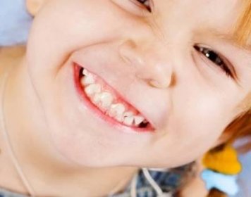 Kolik dětských zubů by mělo být u dětí: počet zubů