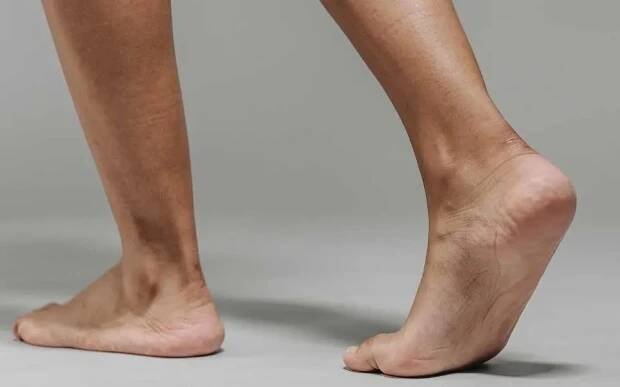 Ankle Fusion