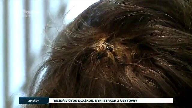 Najednou rána do hlavy, promluvila o napadení žena z Podolí. Na chodník z ní crčela krev