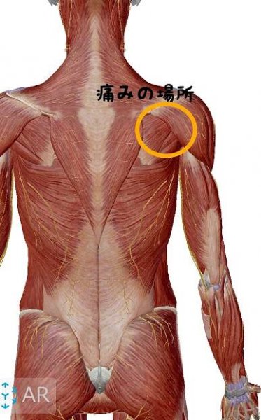 テニスのサーブやスマッシュ時の『肩の痛み』 | コンディショニング＆鍼灸治療院SoL