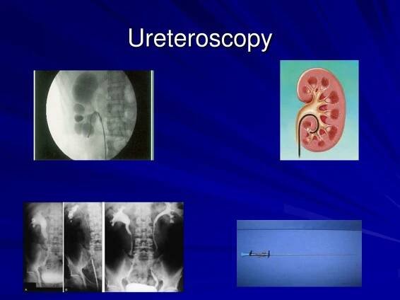 PPT - Urologic Disorders PowerPoint Presentation, free download - ID:334606