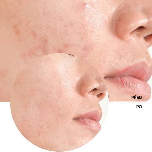 Revox B77 Just Salicylic Acid 2%