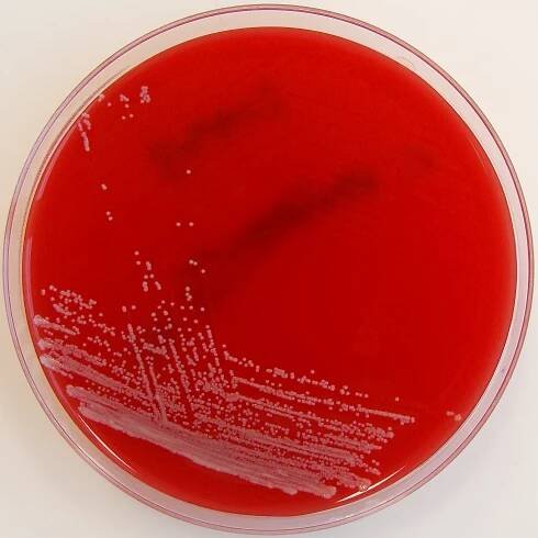 Corynebacterium striatum