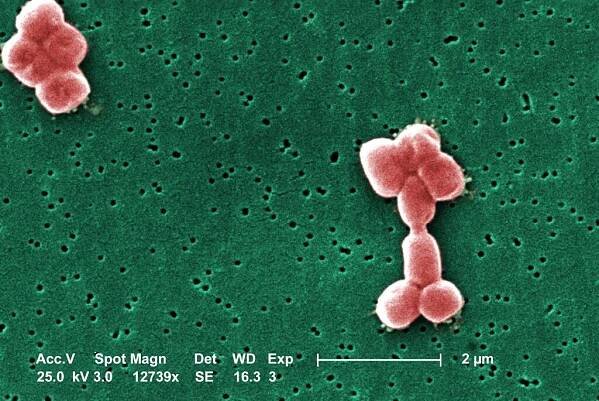 This digitally colorized scanning electron microscopic (SEM) depicts two clusters of Acinetobacter baumannii bacteria